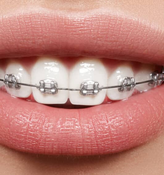 orthodontics